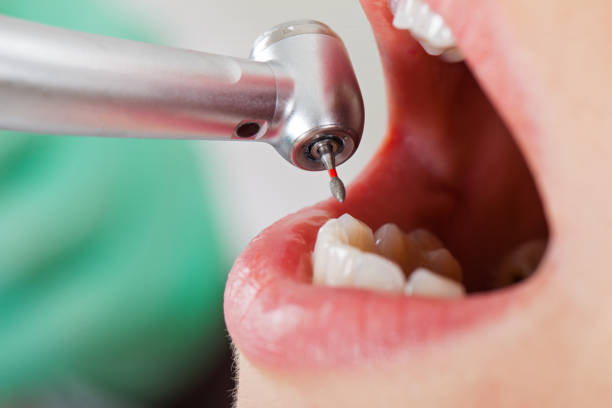 Best Broken or Chipped Tooth Repair in Colonial Heights, VA